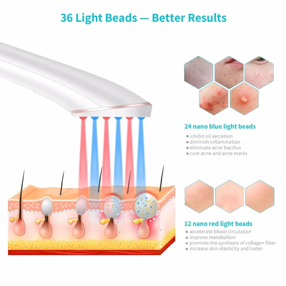 Wireless Rechargeable Acne Light Therapy Device - Euphorale