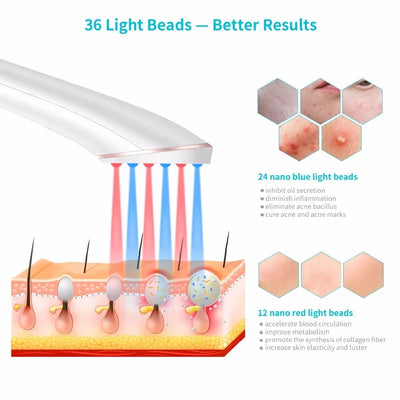 Wireless Rechargeable Acne Light Therapy Device - Euphorale