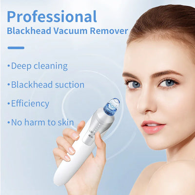 Pore Vacuum Electric Blackhead Suction Device - Euphorale