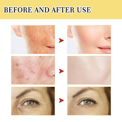 Facial Collagen Snail Serum - Euphorale