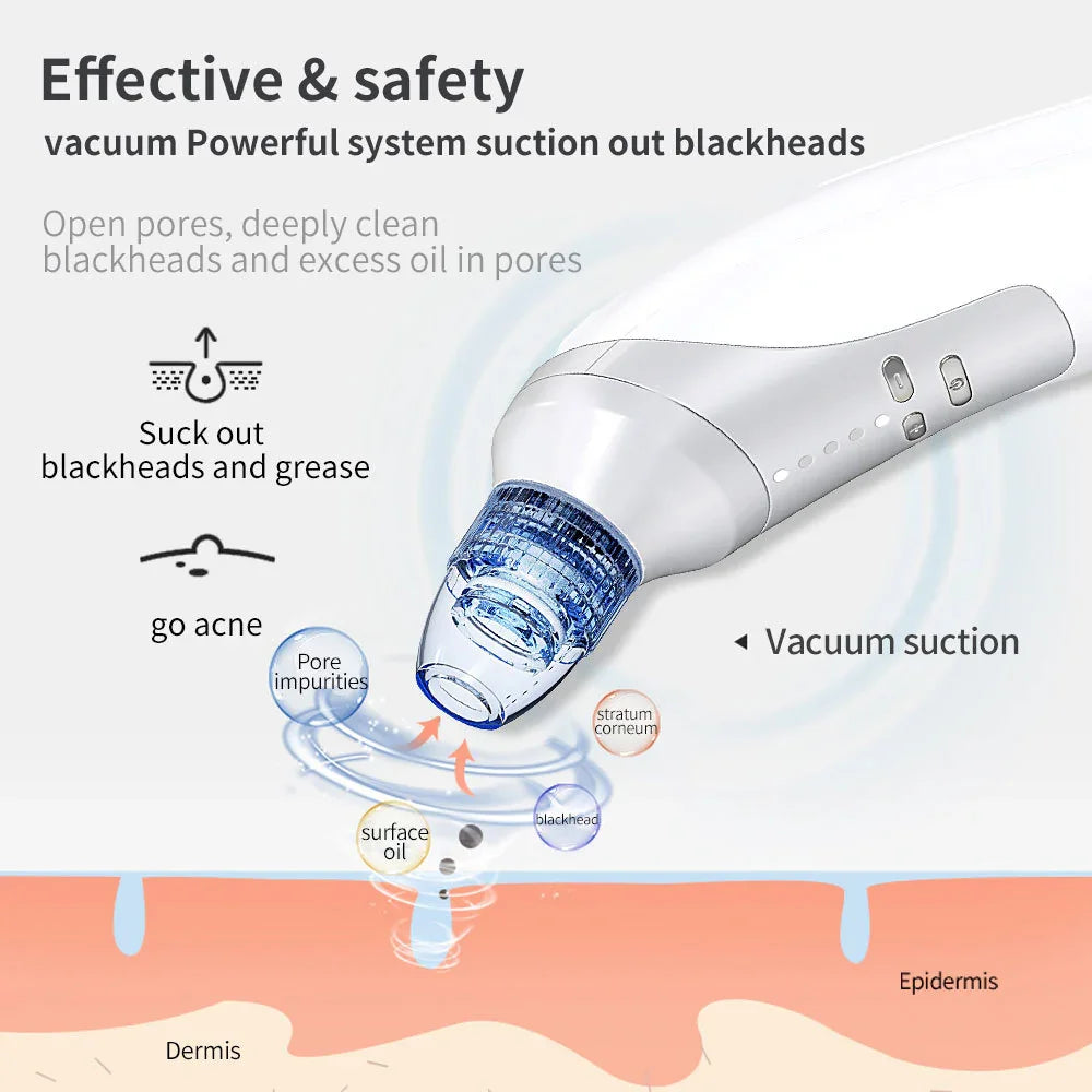 Pore Vacuum Electric Blackhead Suction Device - Euphorale