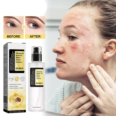 Facial Collagen Snail Serum - Euphorale