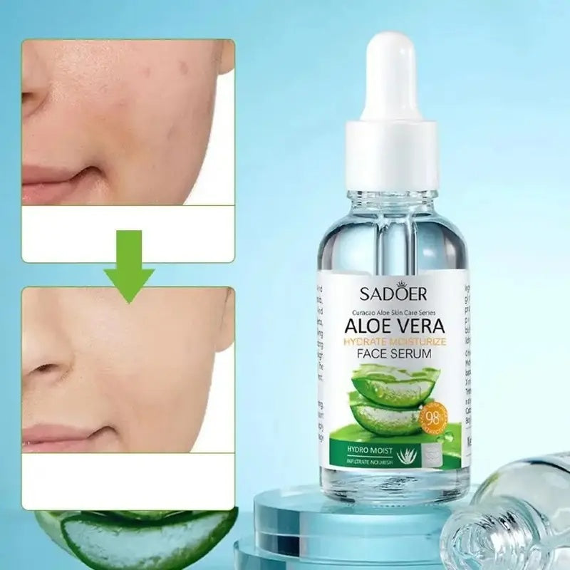 Pure Aloe Vera Gel Hydro Serum - Euphorale