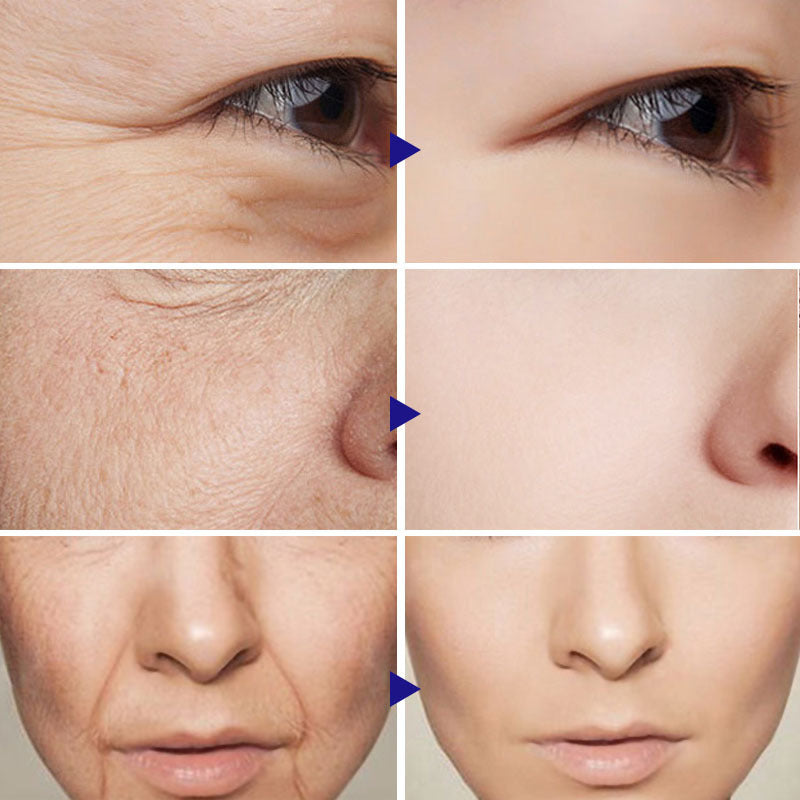Vitamin C Serum Facial Serum - Euphorale