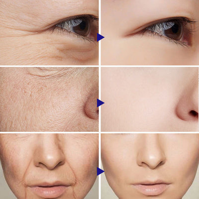 Vitamin C Serum Facial Serum - Euphorale