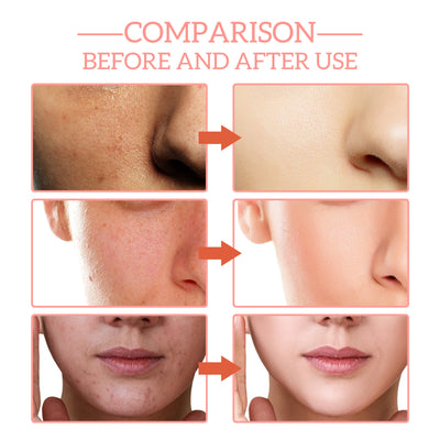 5 In 1 Anti Aging Collagen Facial Serum - Euphorale