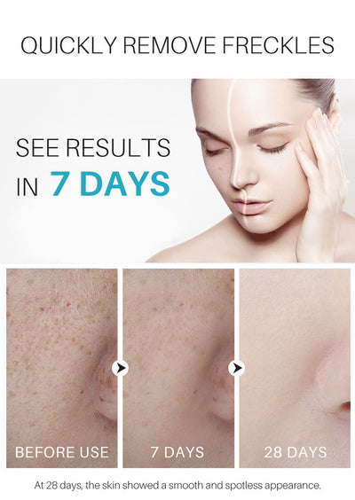 Dark Spot Black Repair Skin Cream - Euphorale