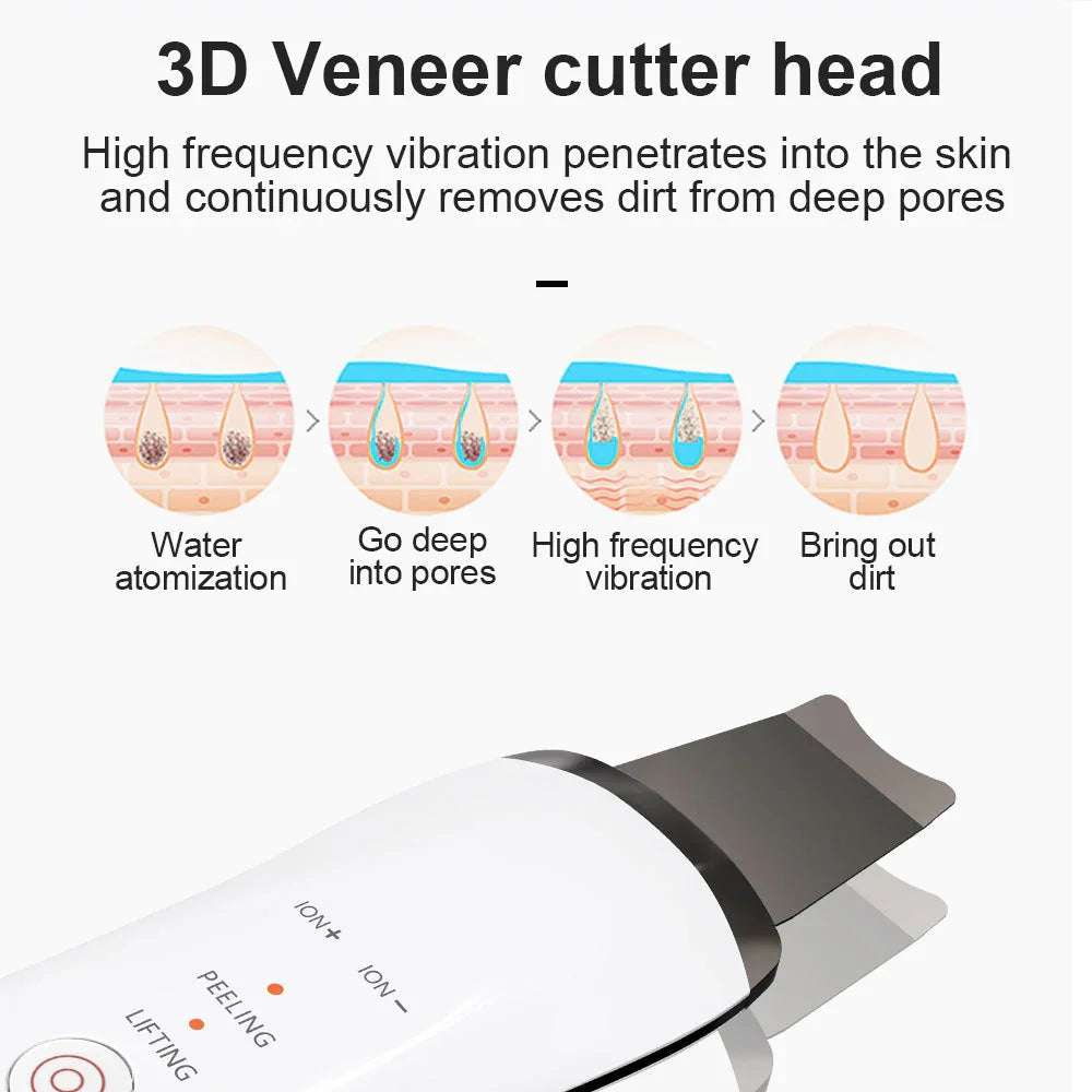 USB Electric Ultrasonic Ultrasonic Facial Cleaner - Euphorale