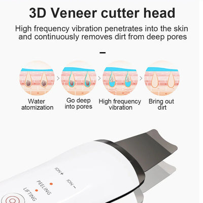 USB Electric Ultrasonic Ultrasonic Facial Cleaner - Euphorale
