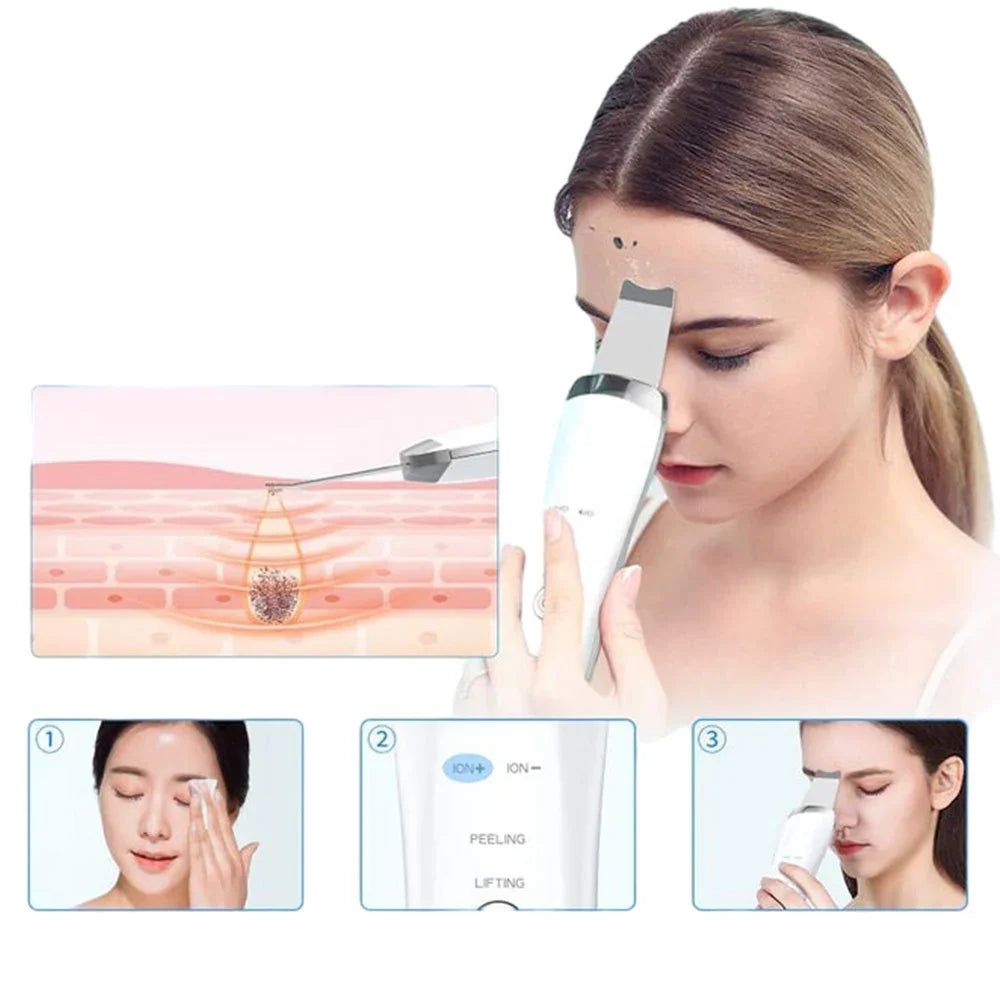 USB Electric Ultrasonic Ultrasonic Facial Cleaner - Euphorale