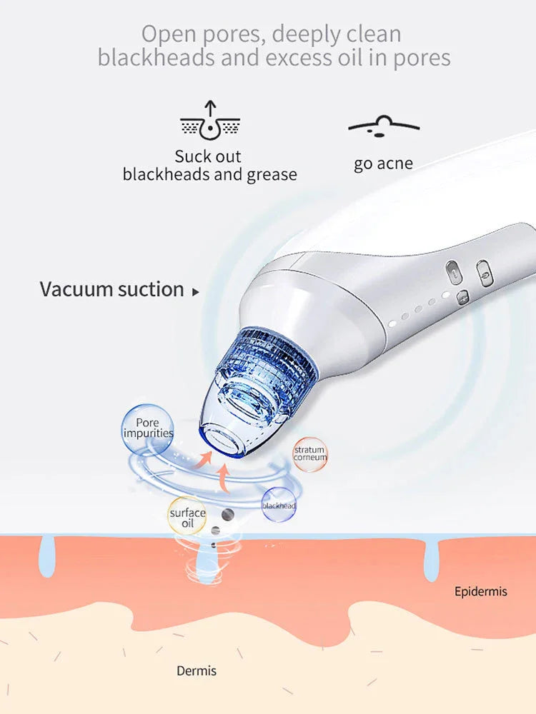 Pore Vacuum Electric Blackhead Suction Device - Euphorale