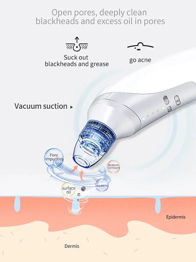 Pore Vacuum Electric Blackhead Suction Device - Euphorale